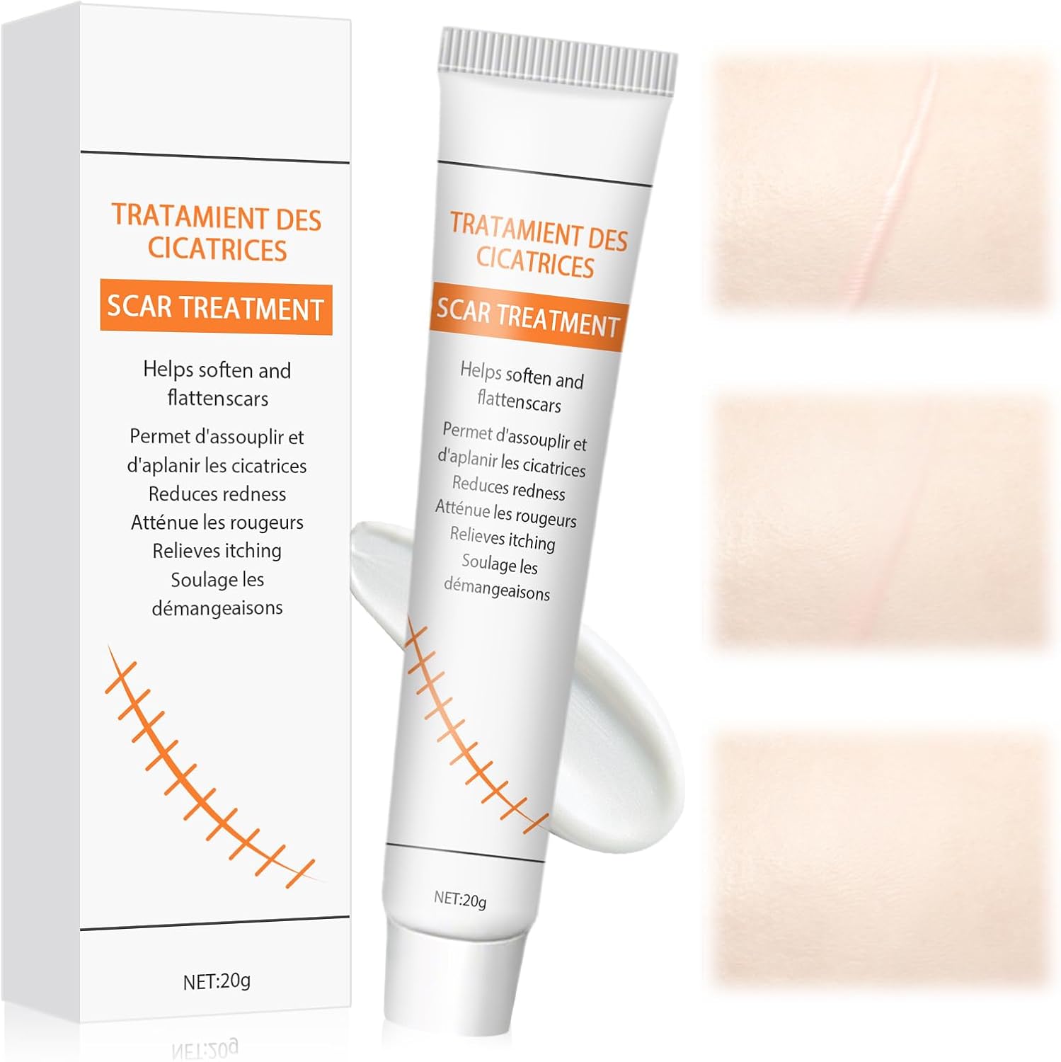 Gel pour Cicatrices, Gel crème Réduit la Visibilité des Cicatrices, Atténue Rougeurs et Démangeaisons, Hydratation Prolongée, gel silicone cicatrice Pour Visage et Corps, 20g Blanc