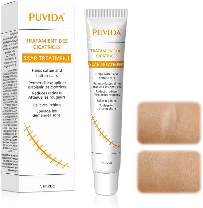 20g Gel pour cicatrices,Gel Cicatrice en silicone Premium, Pour corps, visage, chéloïdes, brûlures,etc cicatrices,Absorption Rapide,réduit visible cicatrices gel cicatrice - Blanc